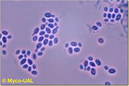 4Saccharomyces